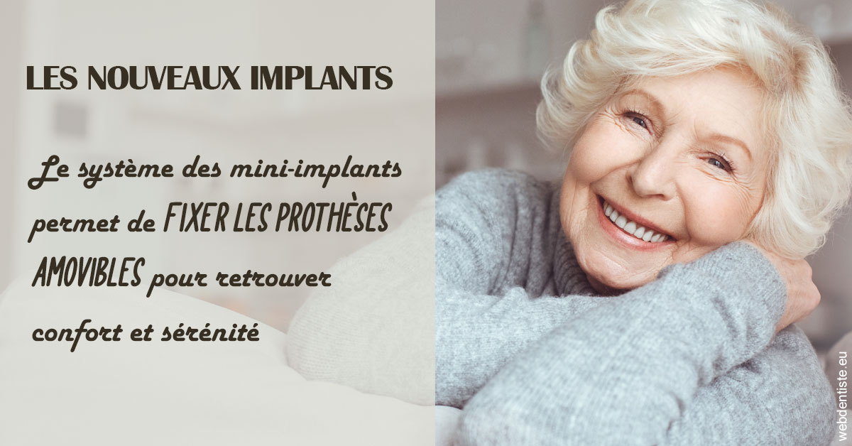 https://dr-hoffmann-julie.chirurgiens-dentistes.fr/Les nouveaux implants 1