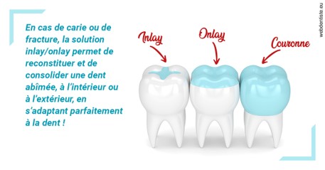 https://dr-hoffmann-julie.chirurgiens-dentistes.fr/L'INLAY ou l'ONLAY