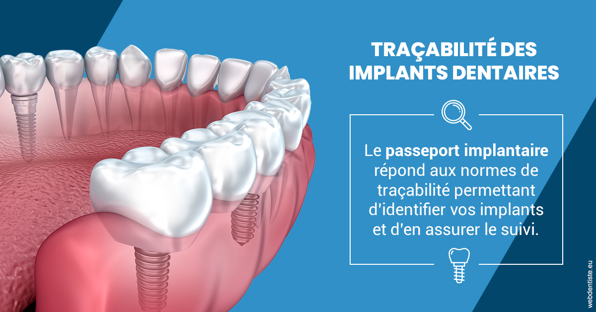 https://dr-hoffmann-julie.chirurgiens-dentistes.fr/T2 2023 - Traçabilité des implants 1