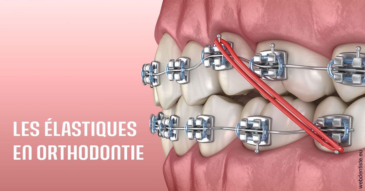 https://dr-hoffmann-julie.chirurgiens-dentistes.fr/Elastiques orthodontie 2