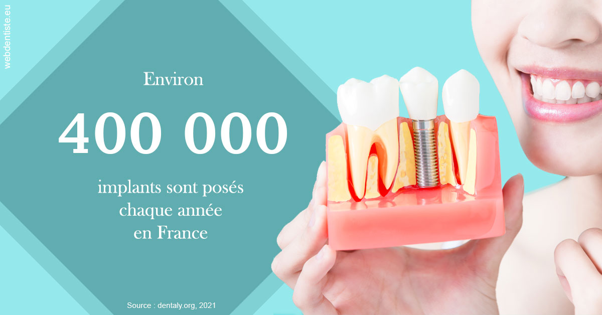 https://dr-hoffmann-julie.chirurgiens-dentistes.fr/Pose d'implants en France 2